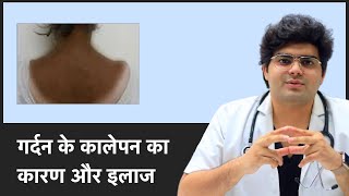 Reasons and Cure For Dark Neck  जानिए कारण और इलाज For Dark Neck  Clear Skin Pune [upl. by Mackay]