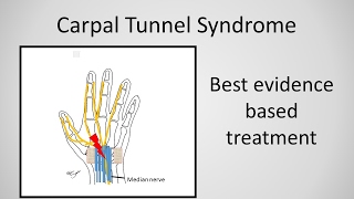 Carpal Tunnel Syndrome [upl. by Dew]