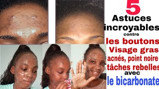 Comment éliminer les boutons tâches points noire visage gras acné avec le bicarbonate 5ASTUCES [upl. by Nitsug]