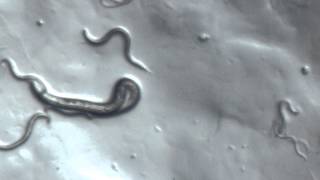 C Elegans under Microscope [upl. by Nodyl]