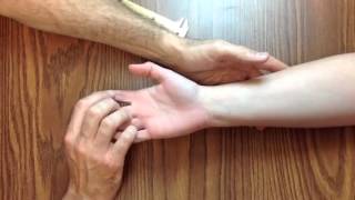 Hand Exam For Carpal Tunnel Syndrome [upl. by Leventis197]