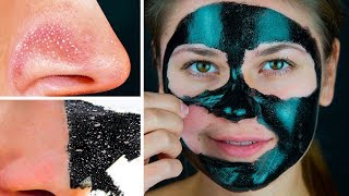 11 Masques Pour le Visage Faciles Avec 2 Ingrédients à Préparer en Une Minute [upl. by Salohcin]