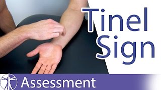 Tinel Sign Wrist  Carpal Tunnel Syndrome Diagnosis [upl. by Belden]