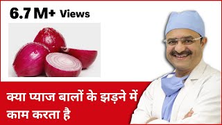 Effectiveness of Onion Juice in Hair Loss क्या प्याज बालों के झड़ने में काम करता है  In HINDI [upl. by Berwick]