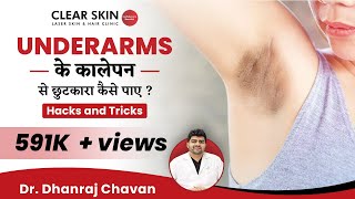 How To Get Rid Of Dark UnderarmsUnderarms के कालेपन से छुटकारा कैसे पाएClearSkin PuneIn HINDI [upl. by Assilanna]